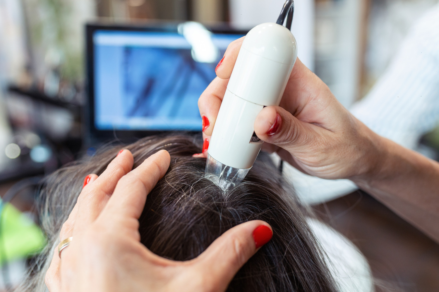 AdobeStock_347505801 What is Hair Loss, and What Causes it?