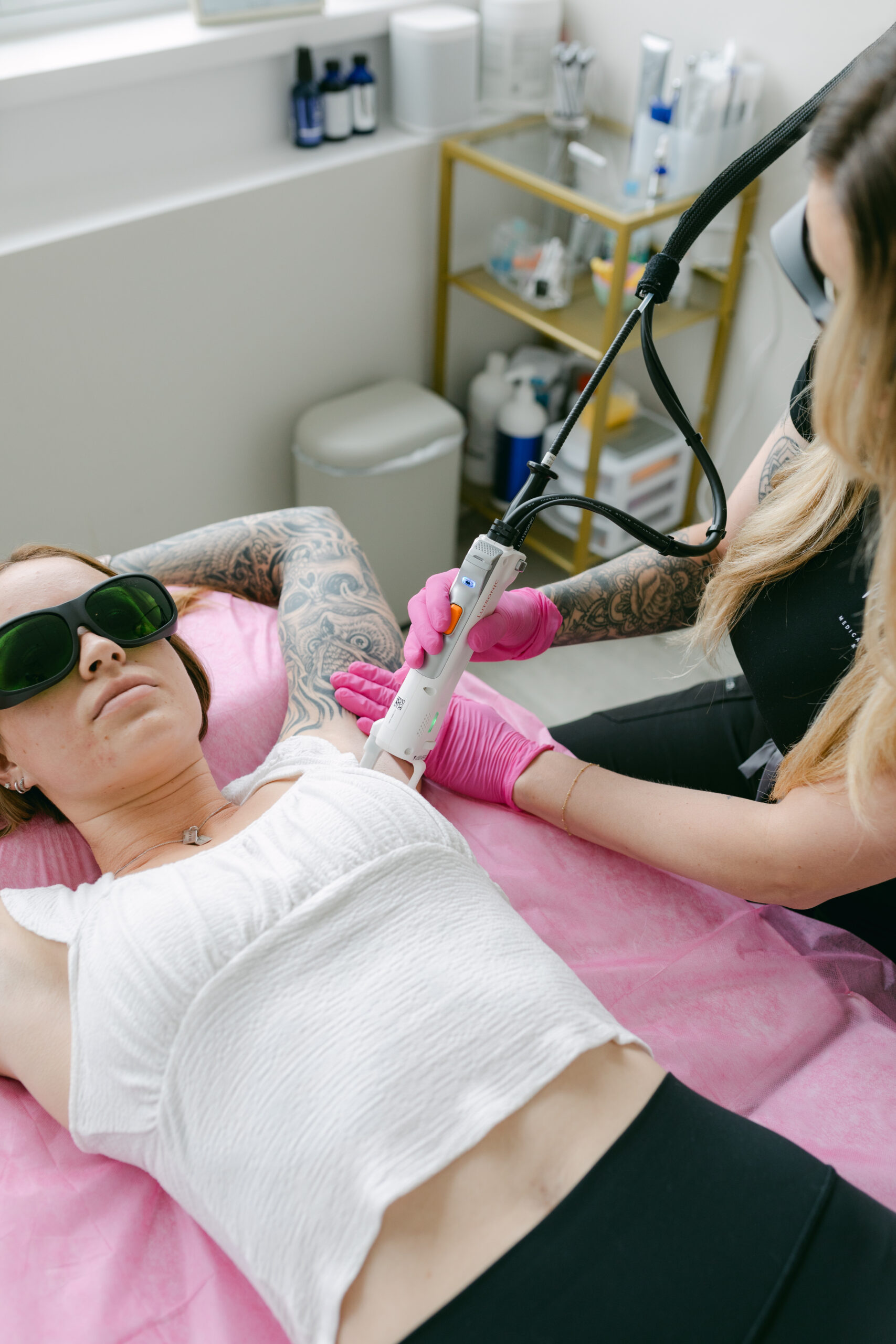 laser hair removal